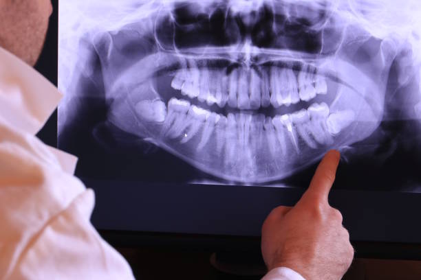 Best Emergency Dental Services for Seniors in East Aurora, NY