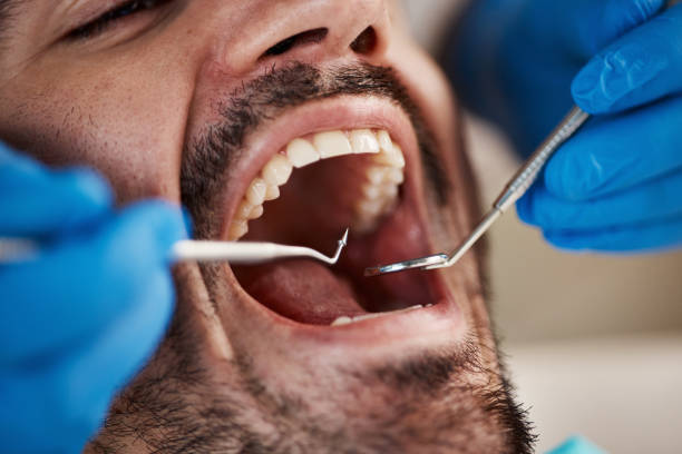 Best Mobile Emergency Dentist in East Aurora, NY