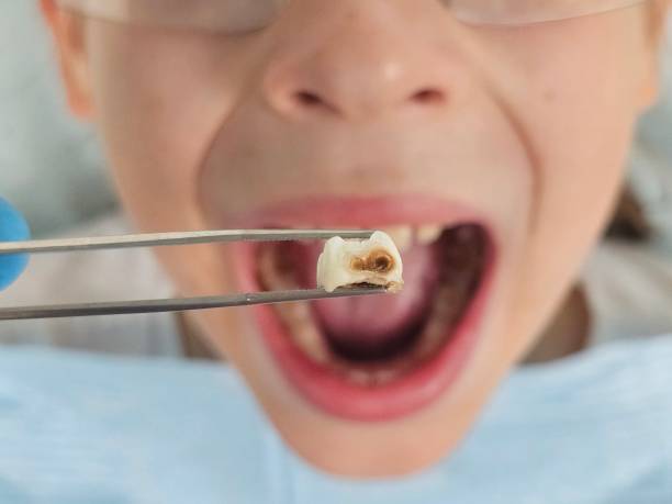 Best Pediatric Emergency Dentist in East Aurora, NY